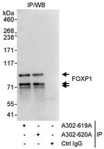 FOXP1 Polyclonal Antibody