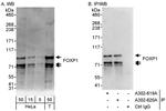 FOXP1 Antibody in Western Blot (WB)