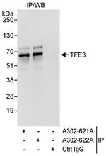 TFE3 Polyclonal Antibody