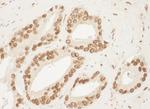 Ku70 Antibody in Immunohistochemistry (Paraffin) (IHC (P))
