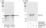 Ku70 Antibody in Western Blot (WB)