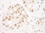 Ku80 Antibody in Immunohistochemistry (Paraffin) (IHC (P))