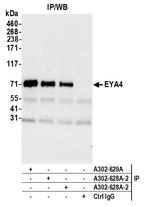 EYA4 Antibody in Immunoprecipitation (IP)