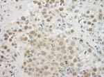 EYA4 Antibody in Immunohistochemistry (Paraffin) (IHC (P))