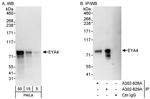 EYA4 Antibody in Western Blot (WB)