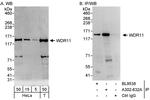 WDR11 Polyclonal Antibody