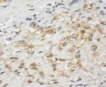LPP Antibody in Immunohistochemistry (Paraffin) (IHC (P))