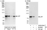 LPP Antibody in Western Blot (WB)