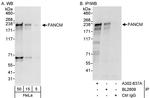 FANCM Polyclonal Antibody