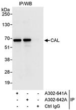 CAL Polyclonal Antibody