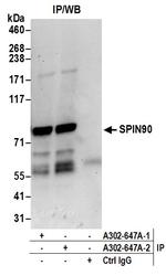 SPIN90 Antibody in Immunoprecipitation (IP)