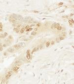 Pygo1 Polyclonal Antibody