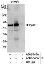 Pygo1 Antibody in Immunoprecipitation (IP)