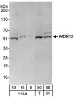 WDR12 Polyclonal Antibody
