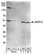 WDR12 Polyclonal Antibody