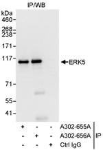 ERK5 Polyclonal Antibody