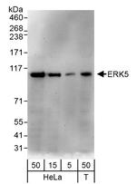 ERK5 Polyclonal Antibody