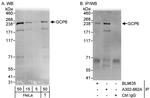 GCP6 Polyclonal Antibody