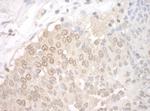 UCKL1 Polyclonal Antibody