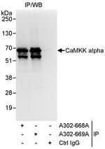 CaMKK alpha Antibody in Immunoprecipitation (IP)