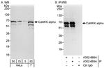 CaMKK alpha Antibody in Western Blot (WB)