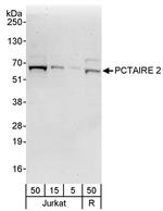 PCTAIRE 2 Antibody in Western Blot (WB)