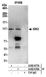 SIK2 Antibody in Immunoprecipitation (IP)