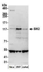 SIK2 Polyclonal Antibody