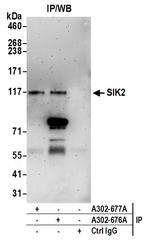 SIK2 Polyclonal Antibody