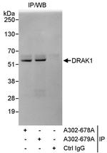 DRAK1 Polyclonal Antibody