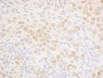 DRAK1 Polyclonal Antibody