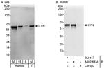 LYN Antibody in Western Blot (WB)