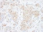 EYA2 Polyclonal Antibody