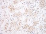 EYA3 Polyclonal Antibody