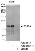 TDRD3 Polyclonal Antibody