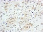 JunB Antibody in Immunohistochemistry (Paraffin) (IHC (P))