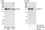 KIF15 Polyclonal Antibody