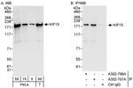 KIF15 Polyclonal Antibody