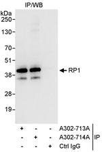 RP1 Polyclonal Antibody