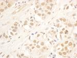 NOP58 Polyclonal Antibody