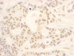 NOP58 Polyclonal Antibody