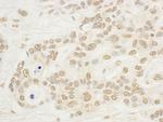 NOP132 Antibody in Immunohistochemistry (Paraffin) (IHC (P))