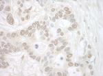 Importin 4 Polyclonal Antibody