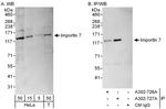 Importin 7 Antibody in Western Blot (WB)