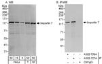 Importin 7 Antibody in Western Blot (WB)