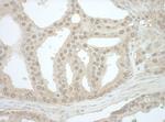 Bin1 Antibody in Immunohistochemistry (Paraffin) (IHC (P))