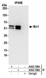 Bin1 Antibody in Immunoprecipitation (IP)