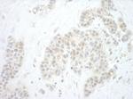 Pygo2 Polyclonal Antibody