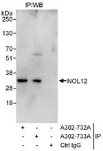 NOL12 Antibody in Immunoprecipitation (IP)