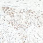 NOL12 Polyclonal Antibody